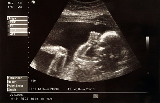 shutterstock_2273180-Ultrasound-550